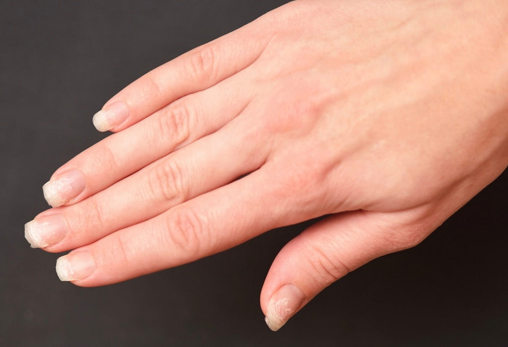 Surprising Things Your Nails Say About Your Health